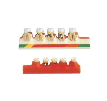 洗牙對(duì)牙齒的影響